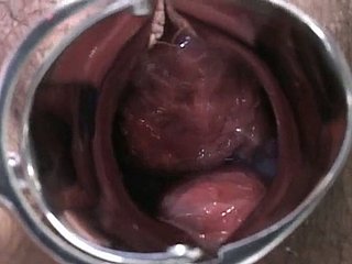 Senhora grávida japonês é examinado e suga lollicock carry out médico