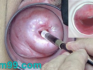 Vajina içine Serviks Cam içindeki Japon Endoskop Kamera